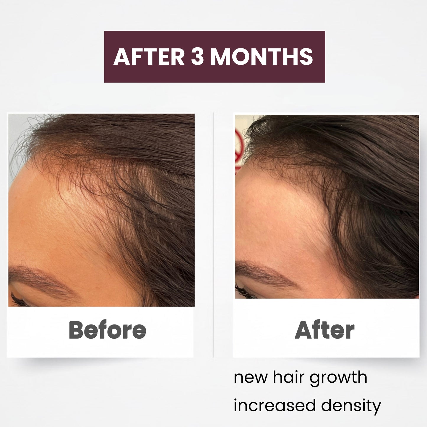 Dr. Zahrah's Hair Growth Elixir