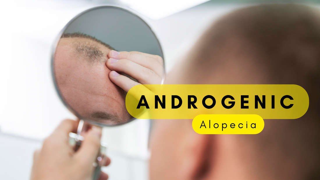 Male and Female Pattern Baldness: Causes, symptoms and Effective treatments.