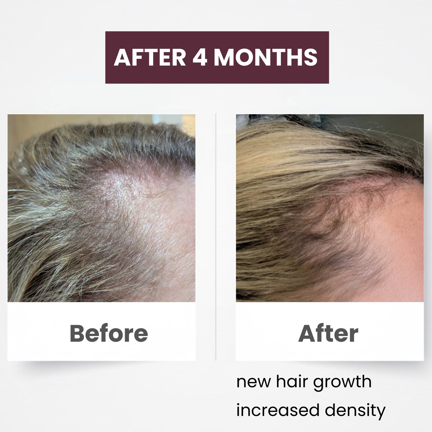 Dr. Zahrah's Hair Growth Elixir